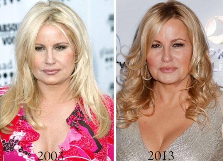 Botox, Facial & Lip Fillers, and Breast Implants!