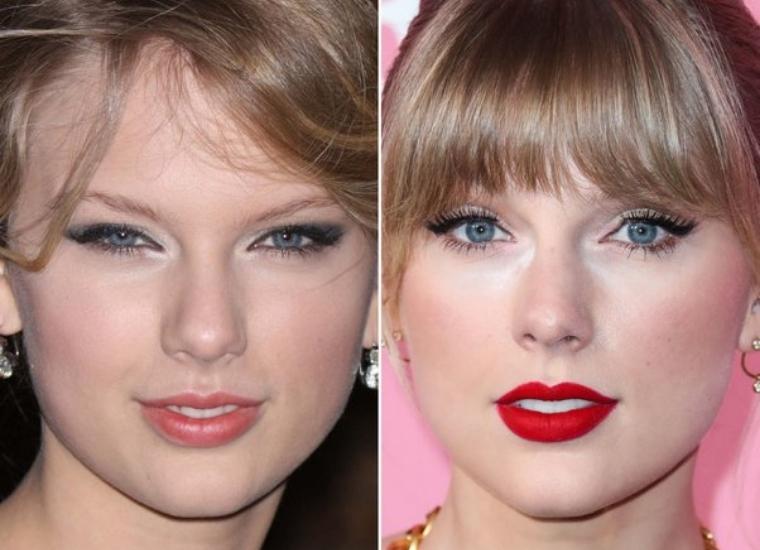 Taylor Swift, Has She Had Plastic Surgery?