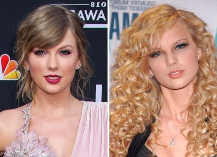 Taylor Swift's Plastic Surgery 2022