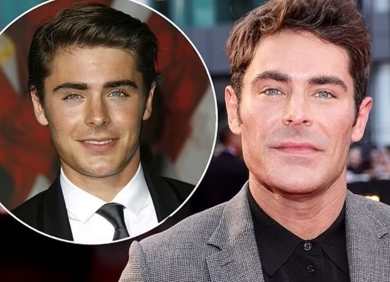 What Happened To The Zac Efron's Jaw?