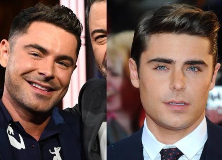 Why Did Zac Efron's Face Change?