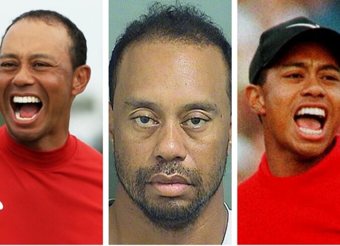 Tiger Woods Plastic Surgery